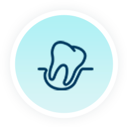 Tooth Extraction Tooth Extraction